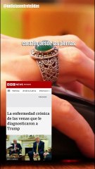 ¿Qué le pasa realmente a las manos de Trump?