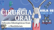 Cirurgia V /// AULA 02 - Infecções Odontogênicas Orais e Maxilofaciais - Odontologia Geral