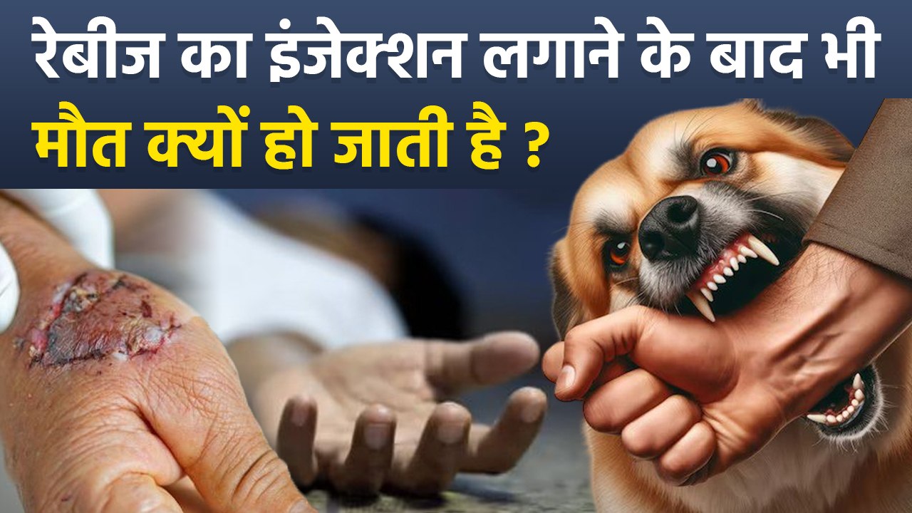 Death After Rabies Vaccine: लगाते वक़्त ना करें ये गलती, हो सकती हैं मौत, Precautions After Dog Bite