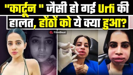 Urfi Javed को पहचानना हुआ मुश्किल! शक्ल का हुआ बुरा हाल, अब Viral हो रहा ये Photo!