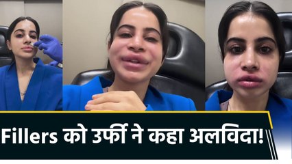 उर्फी ने dissolve कराए Fillers, शेयर किया clinic visit का वीडियो