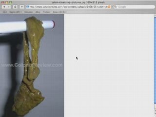 Colon Cleansing With Colonix - Day 38