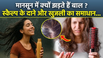 Itchy Scalp In Rainy Season:मानसून में बाल झड़ने और खुजली से कैसे बचें,Treatment In Hindi | Boldsky
