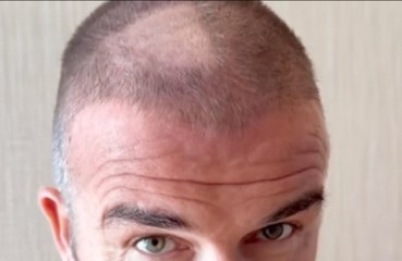David Beckham left with huge bald patch after DIY haircut blunder