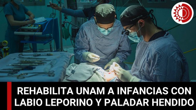 UNAM rehabilita de manera gratuita a infancias con labio leporino y paladar hendido