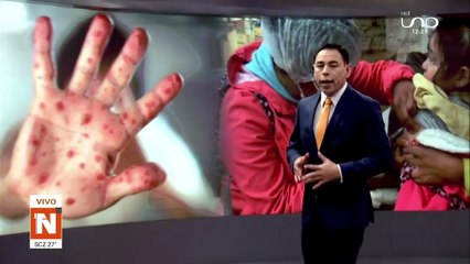 Joven con sarampión sigue desaparecido en Cochabamba y está en fase de contagio