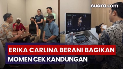 Erika Carlina Berani Bagikan Momen Cek Kandungan, Ditemani Ayah Ibunya