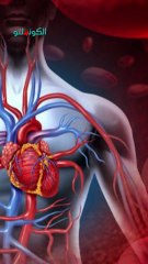 ما هي الدوالي؟ الأسباب والأعراض والعلاج