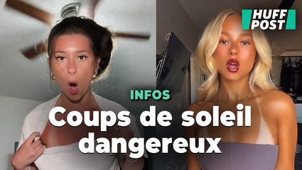 Face à la tendance dangereuse des "burn lines", les dermatos alertent