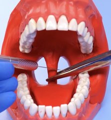 Must-Know Facts Before Your Next Oral Treatment