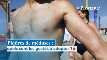 Méduses :que faire en cas de piqûre ?