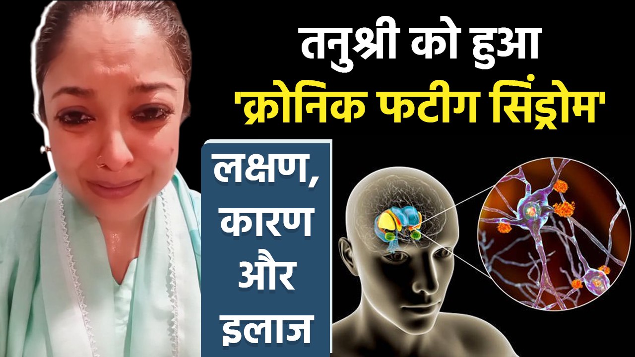 Tanushree Dutta को हुआ Chronic Fatigue Syndrome क्या है, Symptoms, Causes and Treatment...