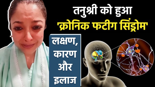 Tanushree Dutta को हुआ Chronic Fatigue Syndrome क्या है, Symptoms, Causes and Treatment...