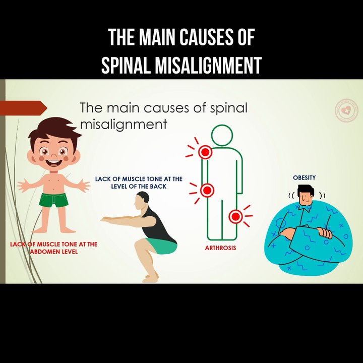 The main causes of spinal misalignment