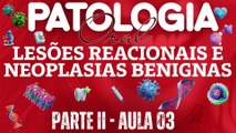 Patologia Oral II /// AULA 03 -  Lesões Reacionais e Neoplasias Benignas - Odontologia Geral