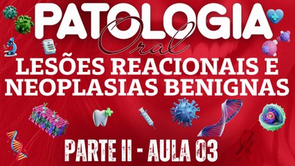 Patologia Oral II /// AULA 03 -  Lesões Reacionais e Neoplasias Benignas - Odontologia Geral
