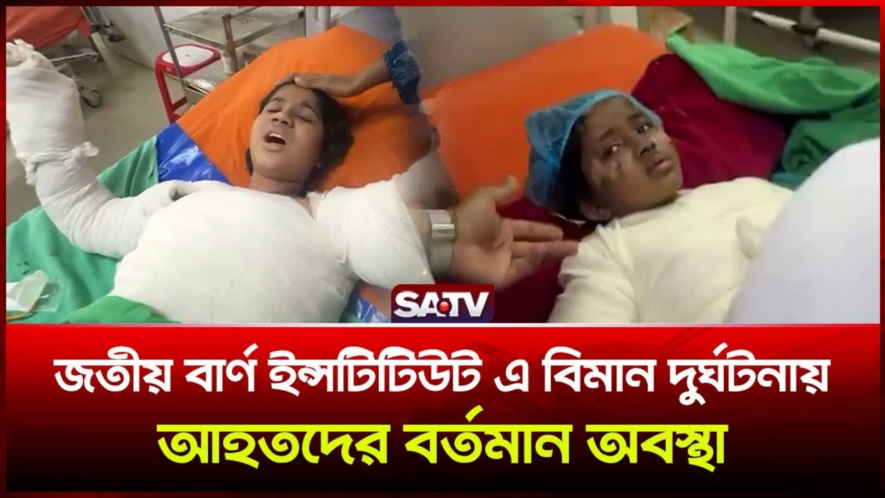 জাতীয় বার্ন ইনস্টিটিউটে আহতদের বর্তমান অবস্থা | Burn Institute Update on Plane Crash Victims