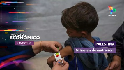 Palestina | Desnutrición infantil acentúa sufrimiento en Gaza