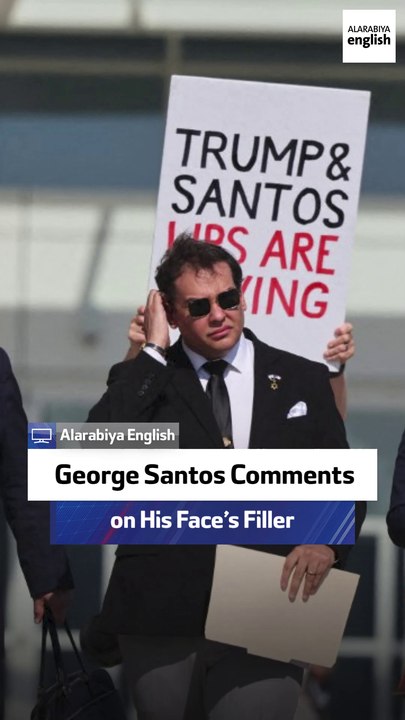 George Santos Comments on His Face’s Filler