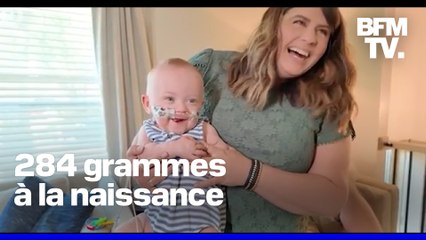 Le plus grand prématuré du monde, né à 21 semaines, a fêté son premier anniversaire