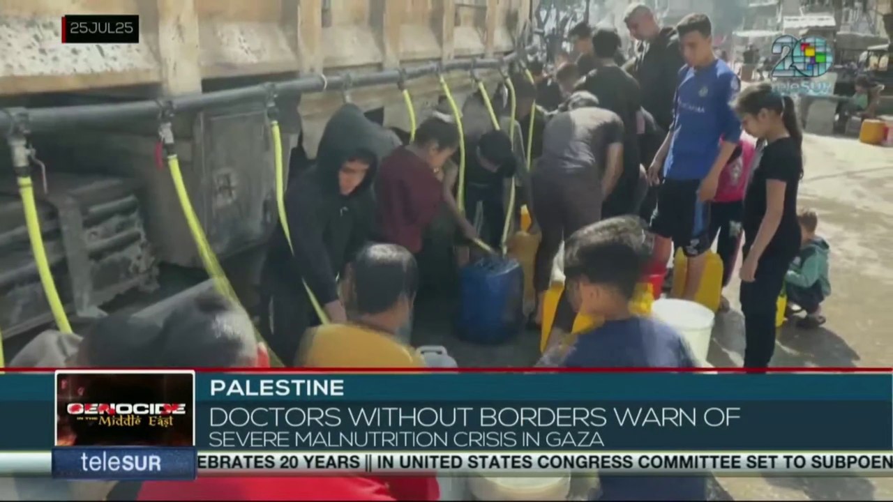 Palestine | Doctors without borders warn of severe malnutrition crisis in Gaza