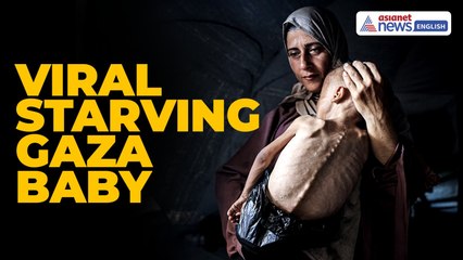 VIRAL Story of Starving Gaza Baby Photo as Aid Groups Clash with Israel Over Blockade