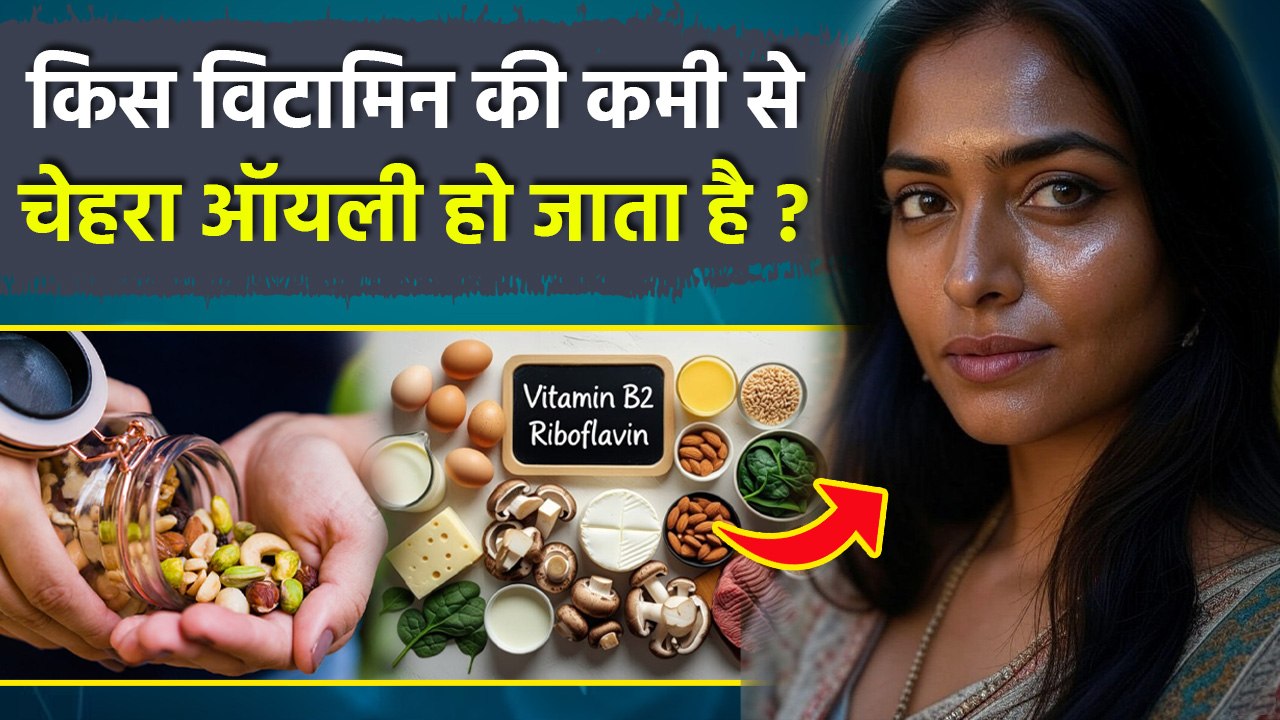 Oily Skin Reason: किस विटामिन की कमी से चेहरा ऑयली हो जाता है | Oily Skin Kis Vitamin Ki Kami Se ?