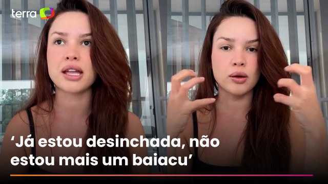 Juliette tranquiliza fãs ao mostrar rosto desinchado após uso de esperma de salmão: ‘Sem filtro'