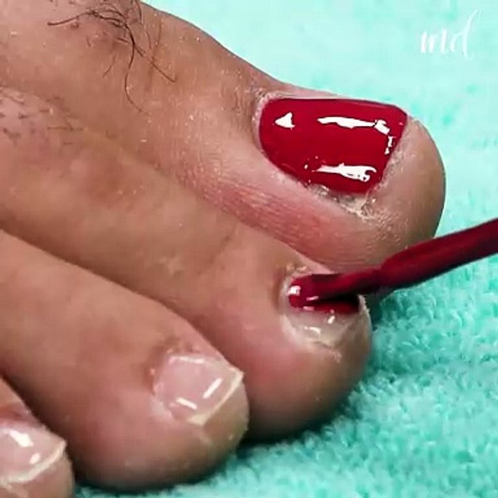 Just about time to get rid of cracked heels🤩