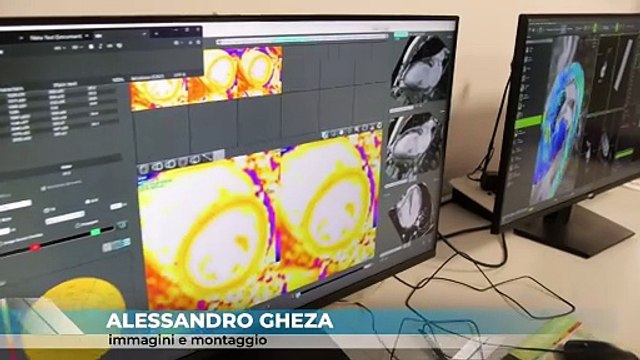 Sanità a Messina, al Policlinico la nuova macchina per risonanze tesla 3