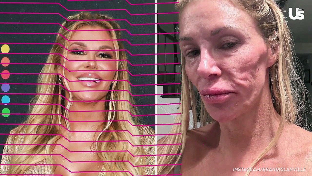 Vicki Gunvalson Claims She Contracted a Parasite Like Brandi Glanville