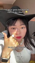 le plus gros bouton de ma vie… au jour J 😭