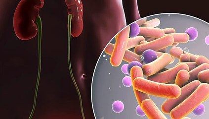 সঘনাই জ্বৰ উঠা প্ৰস্ৰাৱ সংক্ৰমণৰ এটা লক্ষণ নেকি ?