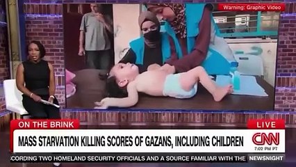 what is starvation looks like Gaza is on the brink