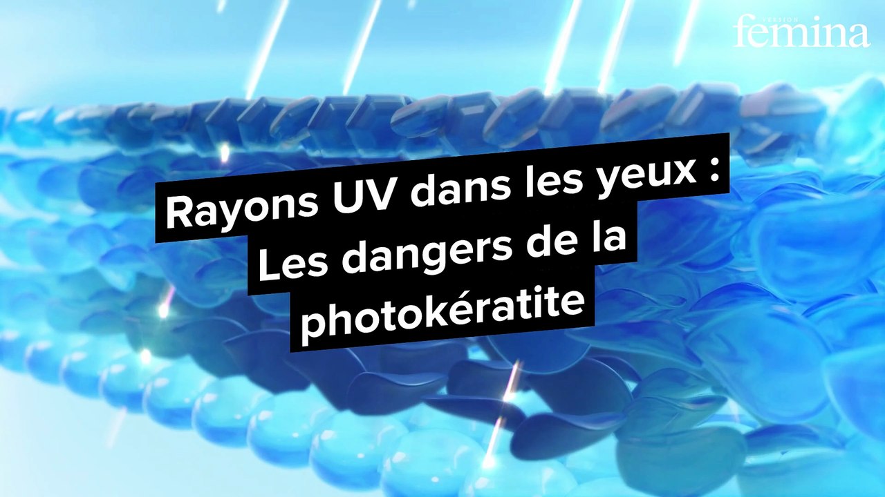 Peut-on attraper des coups de soleil sur les yeux ? La réponse va vous surprendre