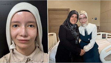 Doğuştan mimiklerini kullanamıyordu, 23 yıl sonra ilk kez gülümsedi