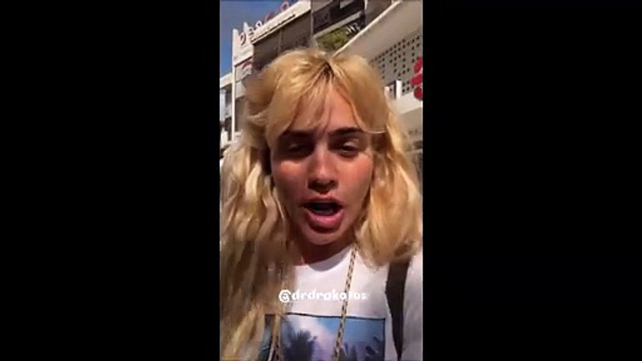 Κόνι Μεταξά: Έβγαλε το υαλουρονικό από τα τα χείλια της και αυτός είναι ο λόγος