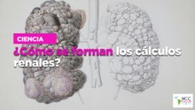 ¿Cómo se forman los cálculos renales?