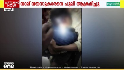തൃശൂർ മലക്കപ്പാറയിൽ നാലു വയസുകാരനെ പുലി ആക്രമിച്ചു.