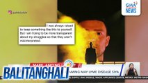 Justin Timberlake, inaming may Lyme disease siya | Balitanghali
