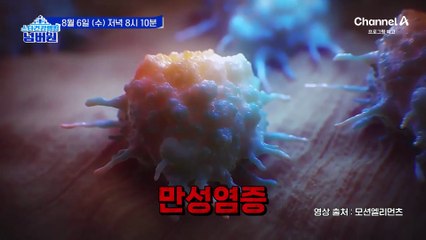 [예고] 작은 염증이라고 무시할 수 없다! 암이 되어 목숨을 위협하는 만성염증