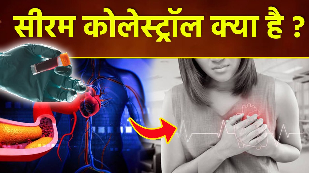 Serum Cholesterol क्या होता है, Causes and Treatment | Boldsky