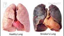 10 ways smoking destroys your body