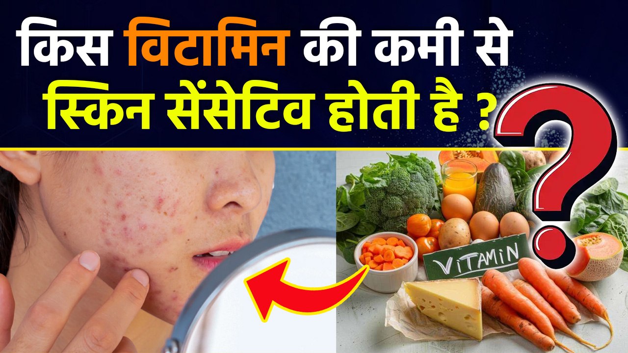 Sensitive Skin Causes: किस विटामिन की कमी से सेंसिटिव स्किन होती है, Vitamin Deficiency Problems...