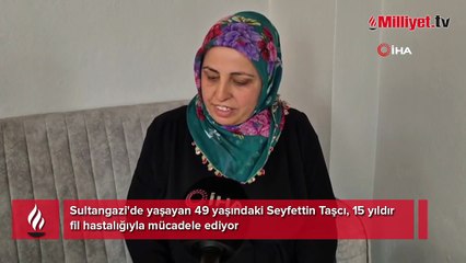 15 yıldır fil hastalığıyla mücadele ediyor: 'Eşim sadece rahat bir ayakkabı giysin'