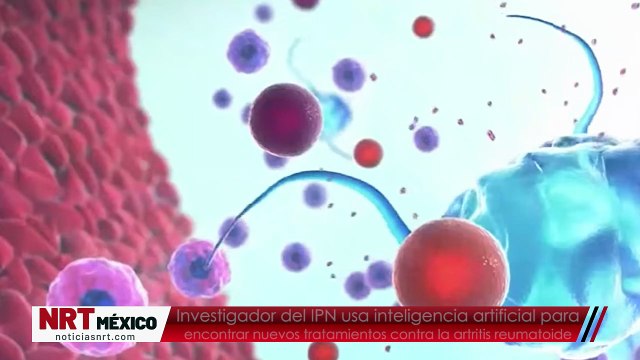 Investigador del IPN usa inteligencia artificial para encontrar nuevos tratamientos contra la artritis reumatoide