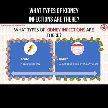 What types of kidney infections are there?