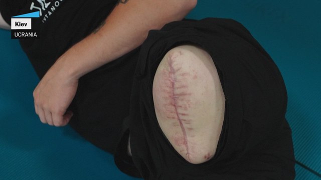 El regreso a Europa de un arma prohibida: las minas antipersona