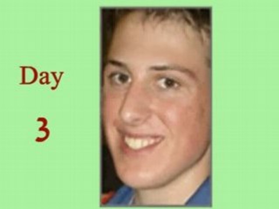 Remove acne in three days - morphing.