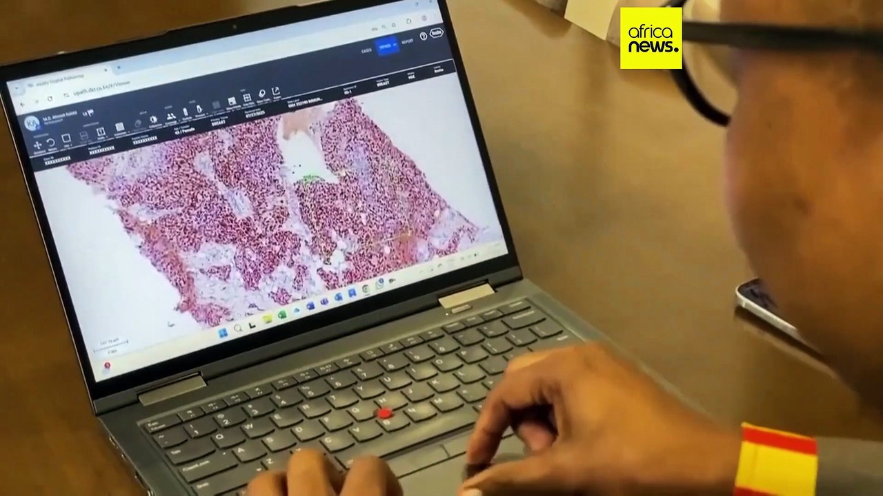 Liver cancer crisis looming as prevention lags, says Lancet report